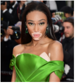 Winnie Harlow